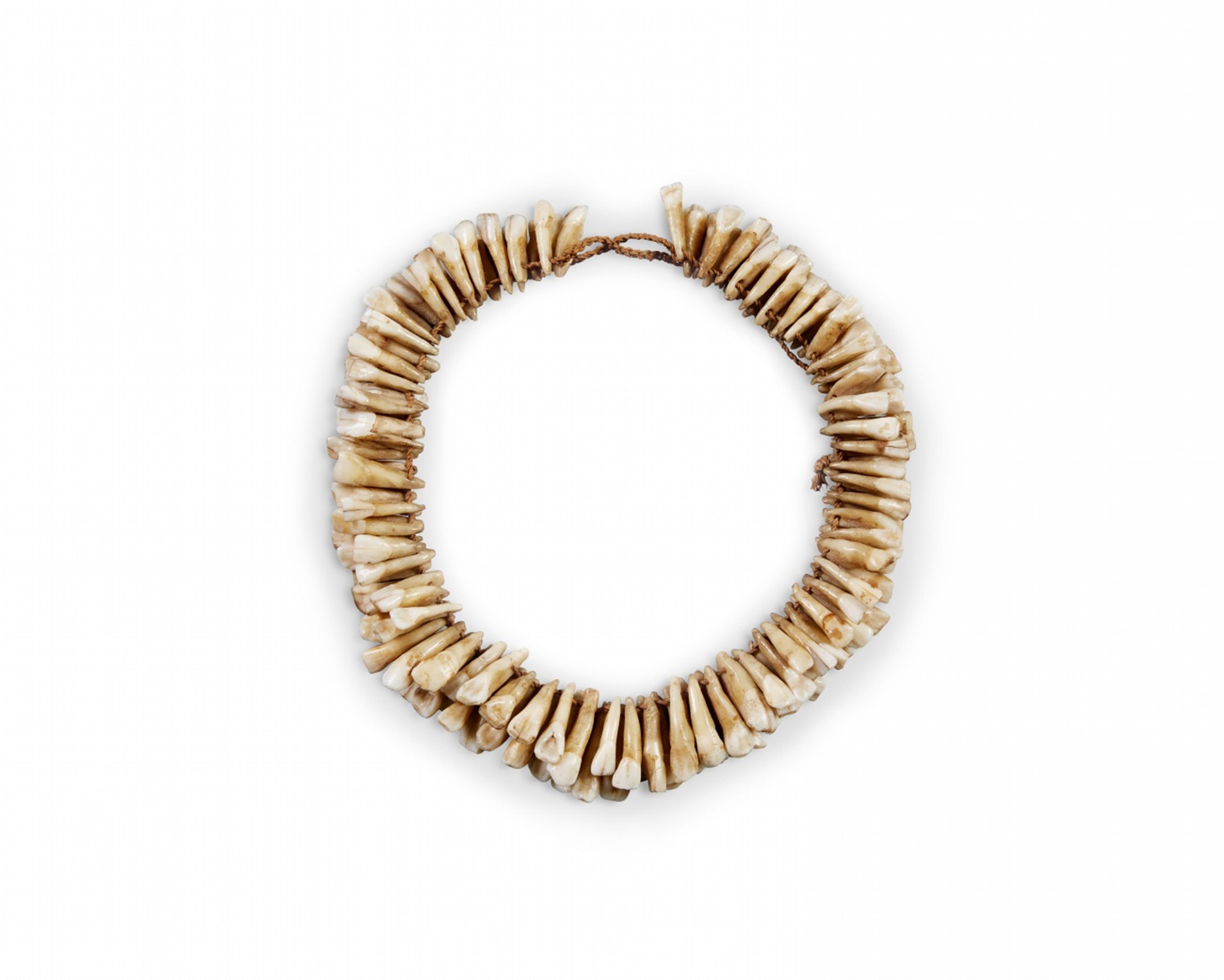 HUMAN TOOTH NECKLACE - image-1